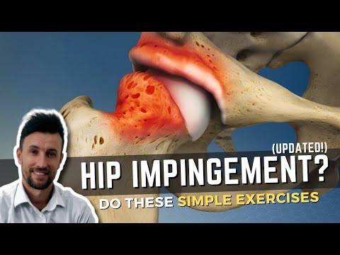 Видео: Выполняете ли вы ЭТИ высокоэффективные упражнения на импинджмент тазобедренного сустава?