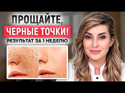 Видео: ЭТИ средства работают на 100%! / 6 ЛУЧШИХ способов ЛЕГКО избавиться от черных точек