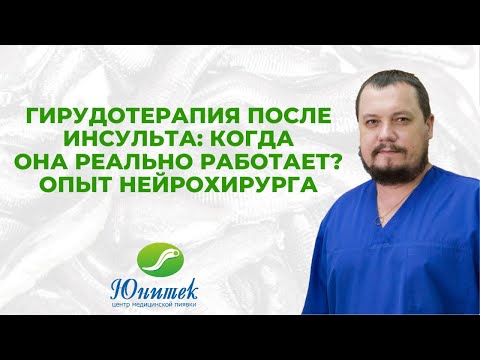 Видео: Гирудотерапия после инсульта: когда она реально работает?