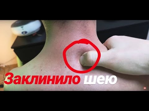 Видео: Устранение триггерных точек и функциональных блоков