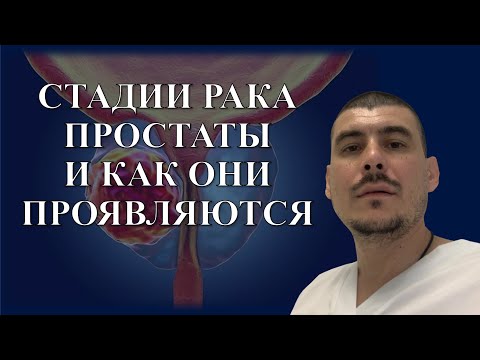 Видео: Стадии РАКА ПРОСТАТЫ и как они проявляются