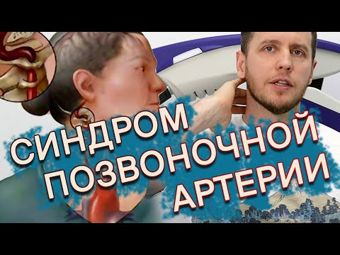 Видео: Диагноз-пустышка | ИНСУЛЬТ - реальные причины