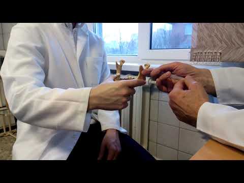 Видео: Анестезия по Берше-Дубову