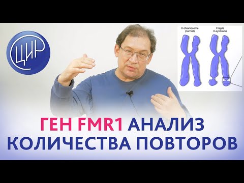 Видео: Ломкая X-хромосома. Ген FMR-1. Анализ количества повторов. Рассказывает Гузов И.И.