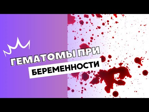 Видео: ГЕМАТОМЫ ПРИ БЕРЕМЕННОСТИ #olenaberezovska #doctorberezovska #беременность #гематомы #прогестерон