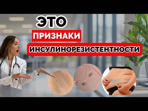 Видео: 5 простых шагов в домашних условиях, чтобы обнаружить инсулинорезистентность