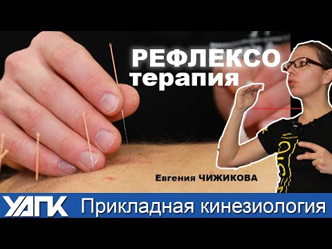 Видео: Коррекция эмоций иглами (Е.Чижикова)