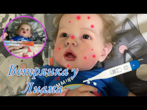 Видео: Ветрянка у Лиама | Реборн заболел reborn got sick