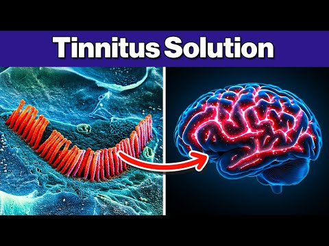 Видео: ШОКИРУЮЩАЯ правда о тиннитусе и вашем мозге