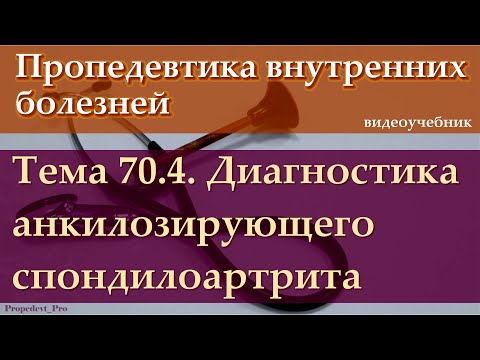 Видео: Тема 70.4. Диагностика анкилозирующего спондилоартрита