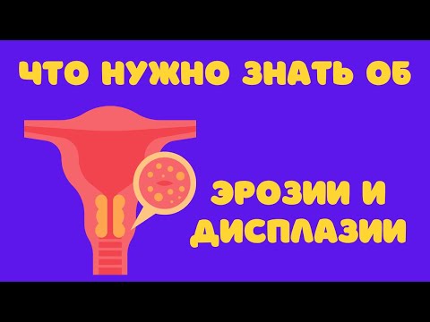 Видео: Что нужно знать об "эрозии" и "дисплазии" @DrOlenaB