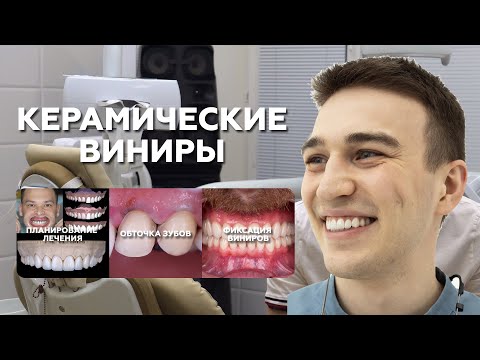 Видео: Керамические виниры: обточка, фиксация, планирование