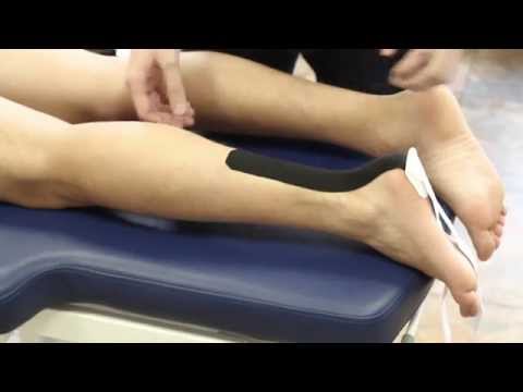 Видео: Кинезиотейпирование ахиллова сухожилия и икроножной мышцы