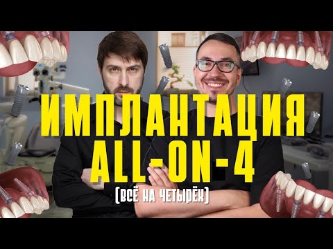 Видео: ИМПЛАНТАЦИЯ ЗУБОВ All-ON-4 | Всё на четырёх