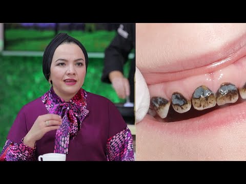 Видео: БОЛАЛАРНИНГ СУТ ТИШЛАРИ КАСАЛЛИГИ ҚАНЧАЛИК ХАВФЛИ?