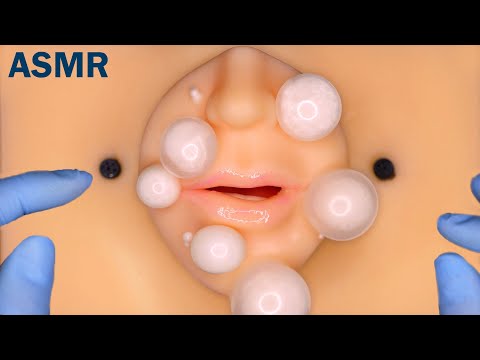 Видео: [ASMR] Ролевая игра по лечению акне (иглоукалывание, пирсинг носа, саб, асмр)
