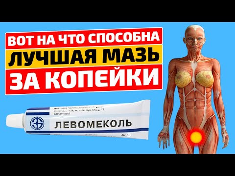 Видео: 10 неожиданных способов применения копеечной мази Левомеколь, о которых вы не знали