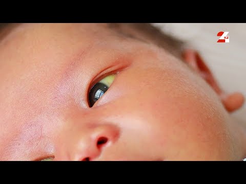 Видео: Сарыауру несімен қауіпті? | Медицина KZ