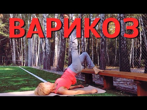 Видео: Варикоз | Упражнения для ног при варикозе | Техники работы с диафрагмой для профилактики варикоза