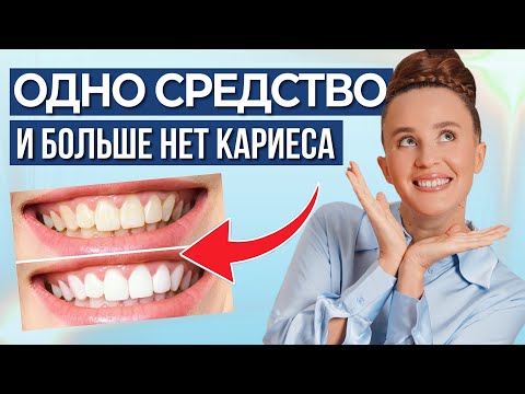 Видео: Зубы восстановились сами! Стоматолог в шоке! Я просто применила одно средство