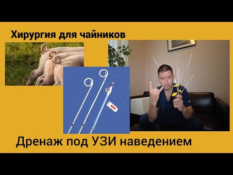 Видео: Хирургия для чайников. Дренирование под УЗИ наведением.