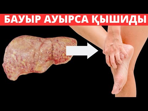 Видео: Бауыр ауырса АЯҚ ҚЫШИДЫ и осы ЖАРАЛАР шығады. Бауыр ауырса не истеу керек