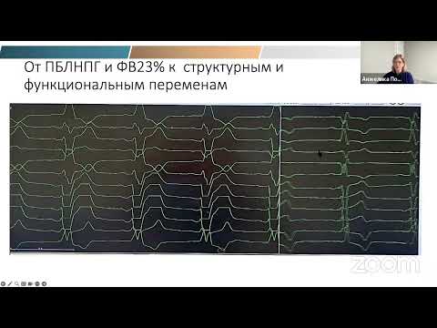 Видео: Основы СРТ: критерии ответа на терапию, оптимизация СРТ и ЭКГ интерпретация