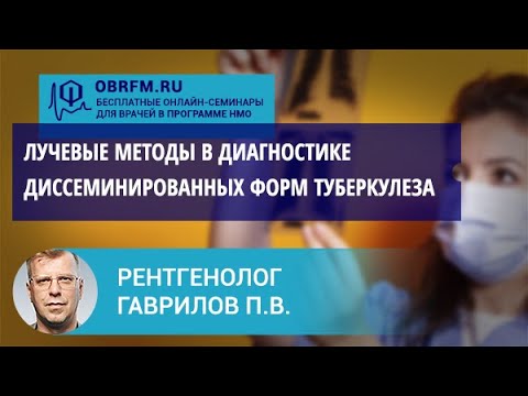 Видео: Рентгенолог Гаврилов П.В.: Лучевые методы в диагностике диссеминированных форм туберкулеза
