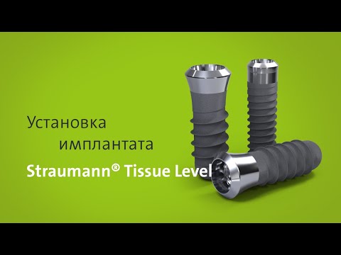 Видео: Установка имплантата: Straumann® Tissue Level