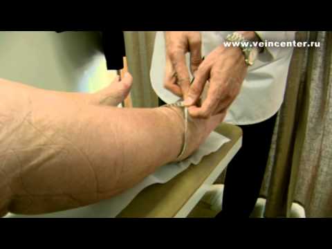 Видео: Лимфодренаж в Клинике Вен Д-ра Мауриньша