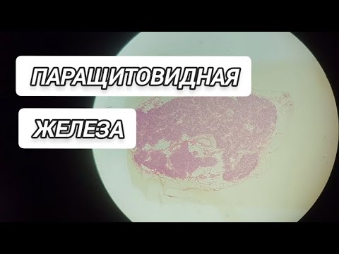 Видео: ПАРАЩИТОВИДНАЯ ЖЕЛЕЗА