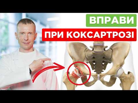 Видео: Чому 80% людей після 40 років мають КОКСАРТРОЗ і як його лікувати