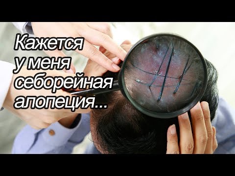 Видео: Кажется у меня себорейная алопеция