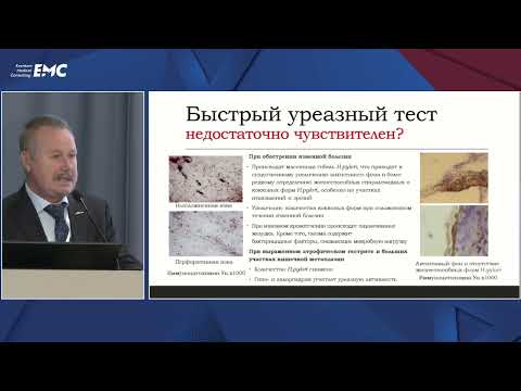Видео: 02   Быстрый уреазный тест: забыть нельзя использовать. Назаров Виталий Евгеньевич