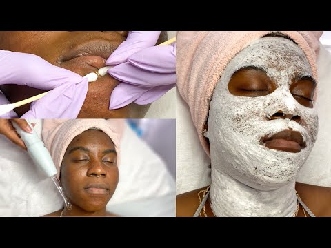 Видео: Глубокое очищение лица кислородом + экстракция крупным планом