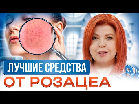 Видео: ЗАБУДЬТЕ про красные щеки! / Как вовремя ПРЕДОТВРАТИТЬ розацеа на коже лица?