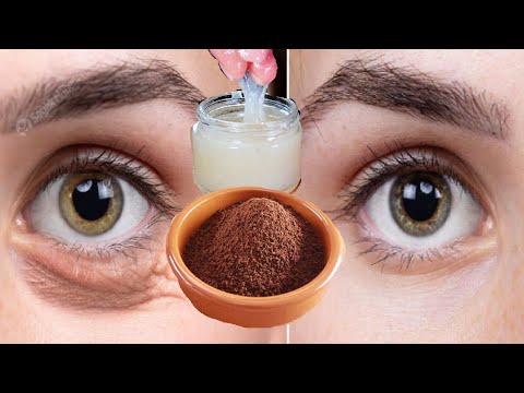 Видео: Молоко и кофе 🫘 За 3 дня избавит вас от всех морщин на лице, независимо от возраста. | Коллаген