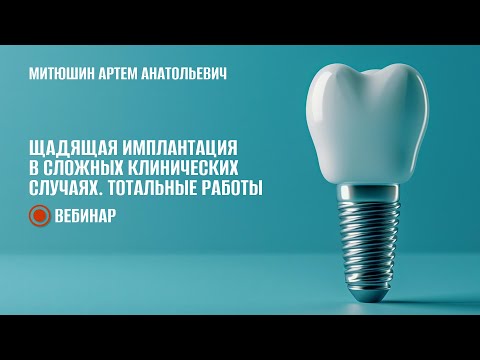 Видео: Щадящая имплантация в сложных клинических случаях. Тотальные работы
