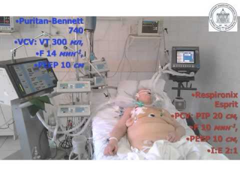 Видео: Вентиляционно-перфузионные отношения (кИВЛ14дек) Лебединский К.М.(1)