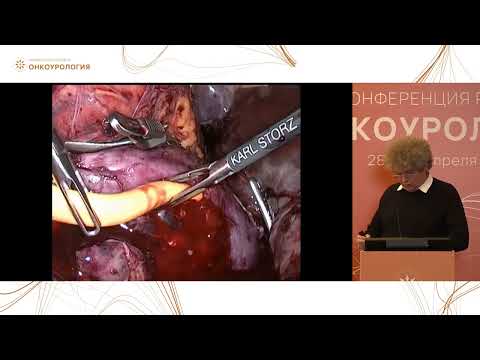 Видео: Разбор клинических случаев по хирургическим подходам и ЛТ в лечении метастатического рака почки