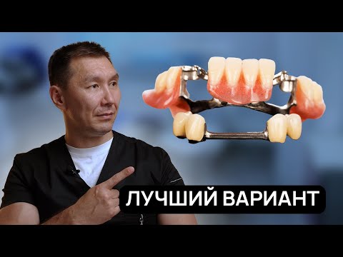 Видео: Лучший СЪËМНЫЙ зубной ПРОТЕЗ в 2025 году. Стоматологи молчат о нем