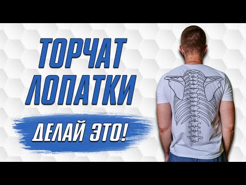 Видео: Что Делать Если у Меня ТОРЧАТ ЛОПАТКИ? Как Убрать Торчащие Лопатки?
