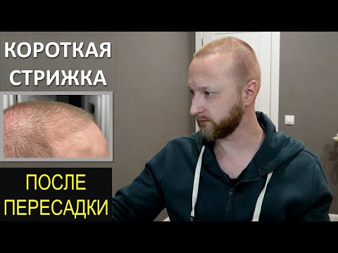 Видео: КОРОТКАЯ СТРИЖКА ПОСЛЕ ПЕРЕСАДКИ