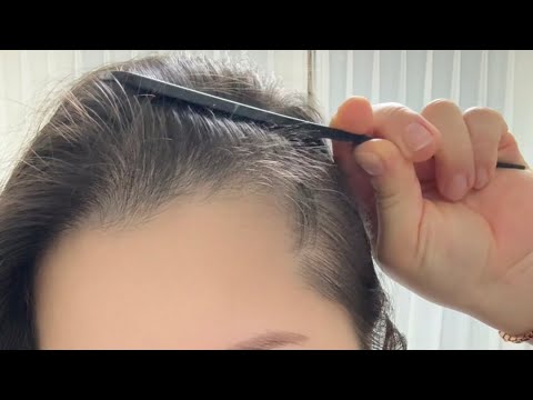 Видео: 2 месяца на миноксидиле — волосы растут как ёжик!