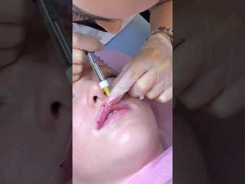 Видео: Губы бантик(2)