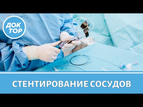 Видео: Когда делать стентирование сосудов
