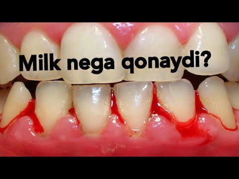 Видео: Milk nega qonaydi?  МИЛК НЕГА КОНАЙДИ?