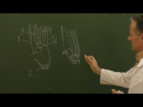 Видео: Пластика паховых грыж по Бассини