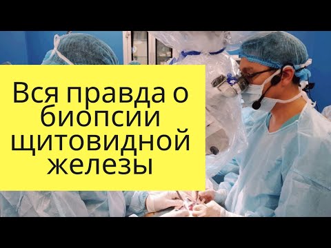 Видео: Вся правда о биопсии щитовидной железы
