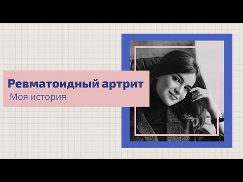 Видео: Моя история: Татьяна Бобошко о ревматоидном артрите, важности ранней диагностики и ремиссии